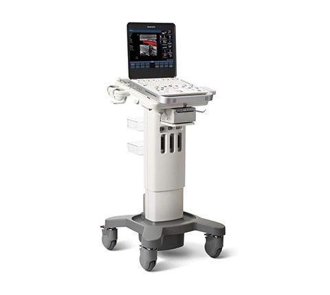 Philips CX50 Ultrasound in the Synchrony Labs facility